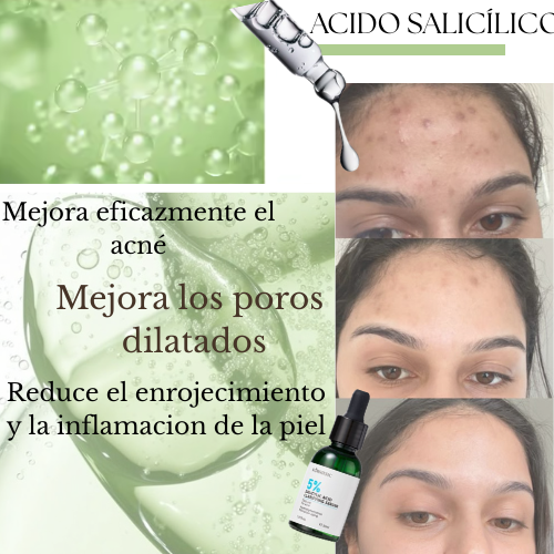 Salicé 5%- Kormesic
